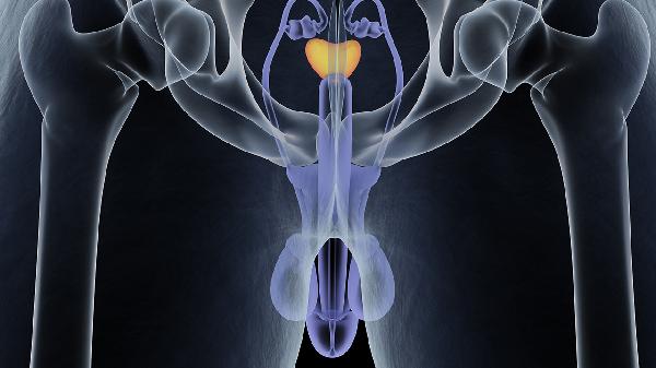 高促性腺激素型性功能低下怎么回事,怎么办