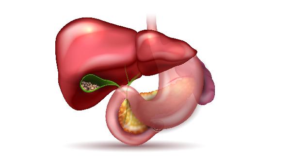 胰腺癌是什么 胰腺癌的癥狀和類型詳述
