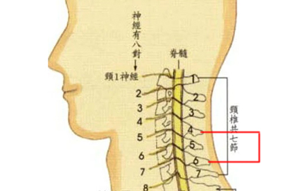 颈椎钙化怎么回事 颈椎钙化的几个原因密切相关