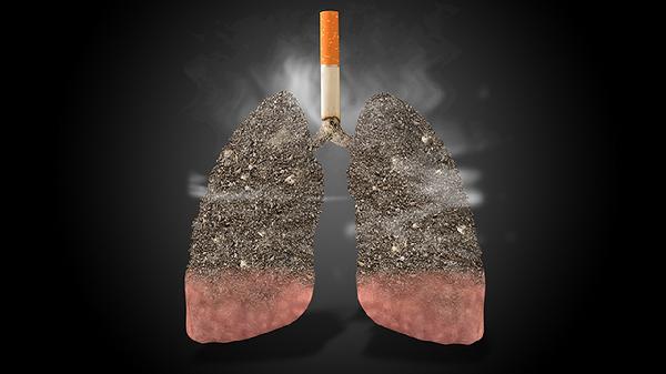 肺气囊是什么引起的 3个原因会导致肺气囊