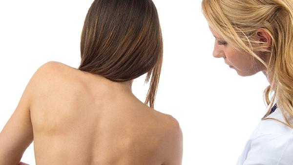 红斑狼疮患者劳累的后果有哪些