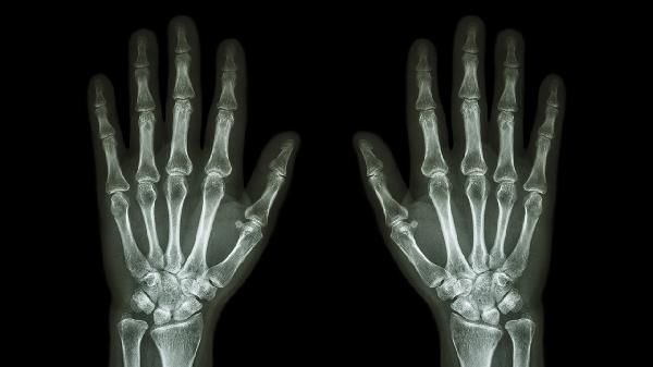 大拇指关节响怎么回事 大拇指关节响的常见原因分析