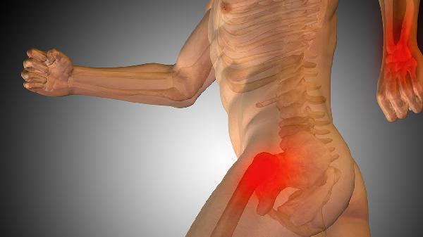 股骨颈骨折患者注意哪些饮食禁忌