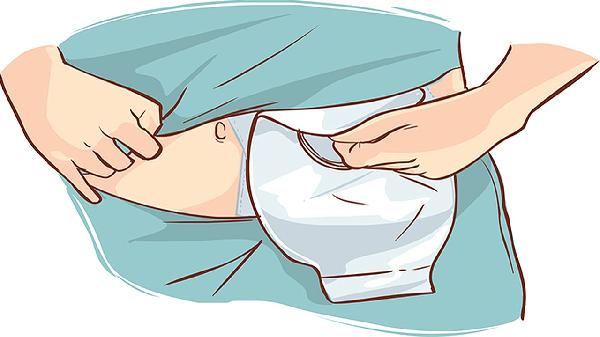 食道裂孔疝怎么治療 食道裂孔疝的3個療法詳述