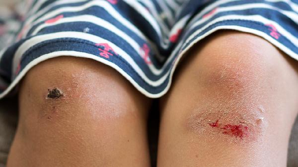 小腿酸胀是怎么回事,怎么办