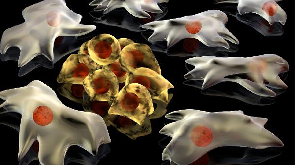 巨幼细胞性贫血有哪些症状