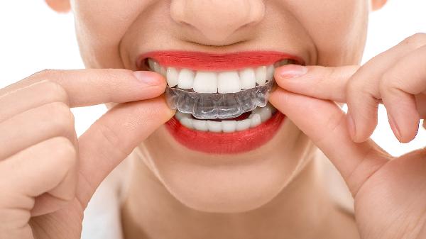 一起来关注下牙齿矫正的注意事项有哪些