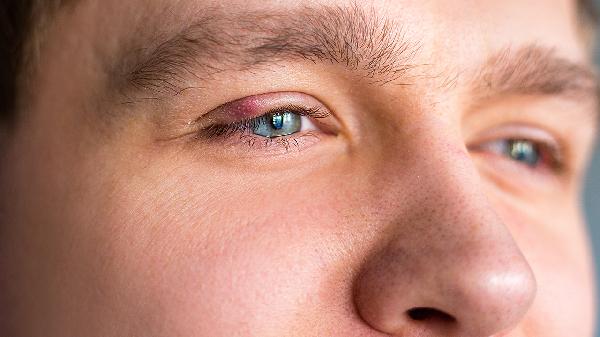 全麻第二天眼睛近距离看不清