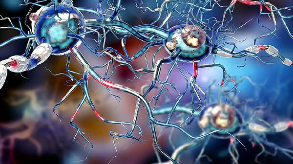 运动神经元病能引起颈椎痛吗