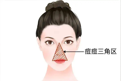 屁股一到夏天长痘痘是什么原因