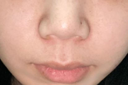 宝宝吐奶从鼻子嘴巴出来怎么回事