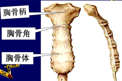 胸骨柄骨折会造成什么后果