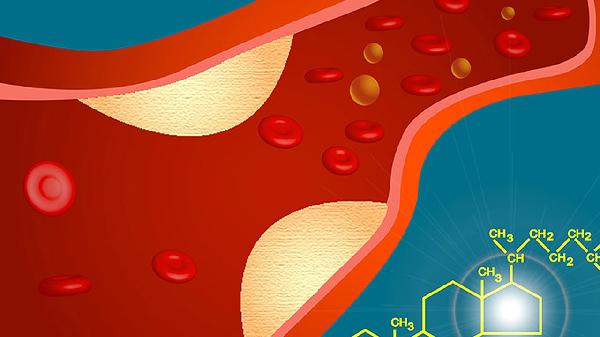 猪油真的是百害无一利吗？是血管“杀手”？医生告诉你真相