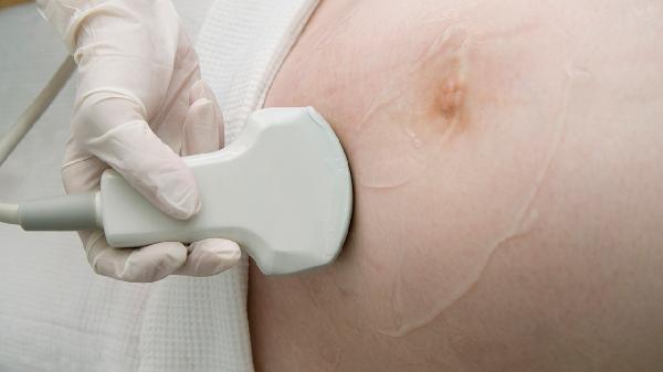 做腔内彩色多普勒超声检查注意事项有哪些