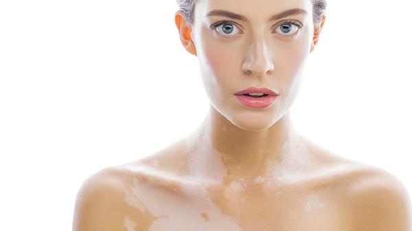 成人脸一边大一边小是什么原因引起的