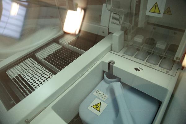 皮质醇增多症的实验室检查