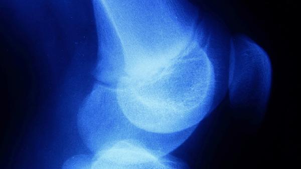 肋软骨膜炎的症状有几种 肋软骨膜炎3症状隐藏很深