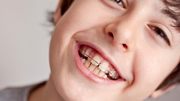 14岁的孩子牙齿矫正可以吗