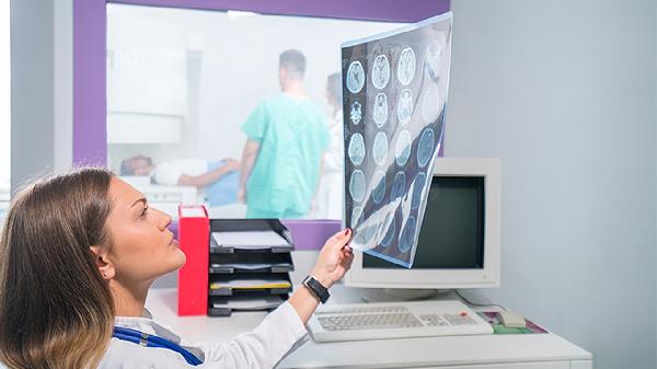 TCT筛查低度鳞状上皮内病变是什么意思