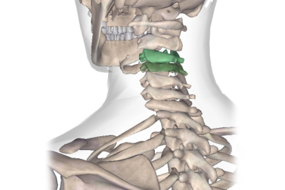 颈椎膨出增生压迫神经怎么办