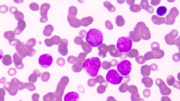 运动神经元病都需要查什么