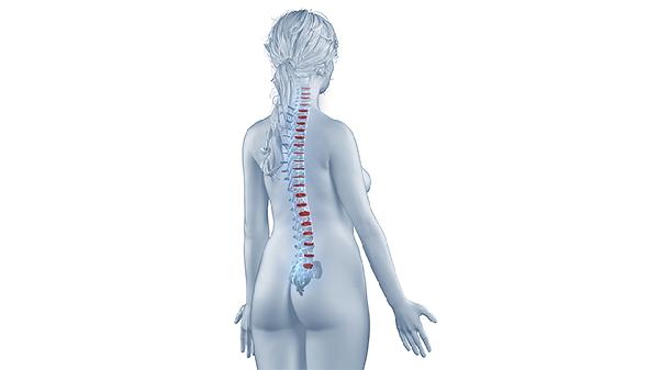 强直性脊柱炎早期查血能查出来吗 强直性脊柱炎早期需做什么检查