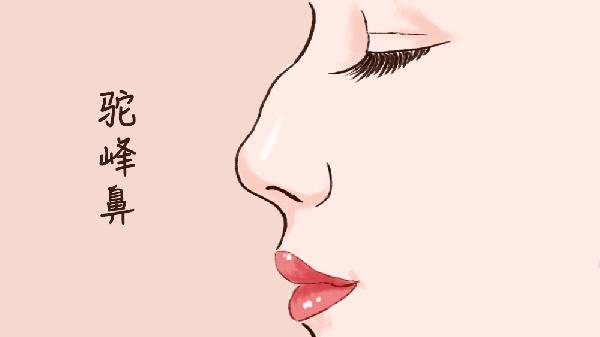 鼻部整形术后如何护理 鼻部整形术的3个护理方法分享