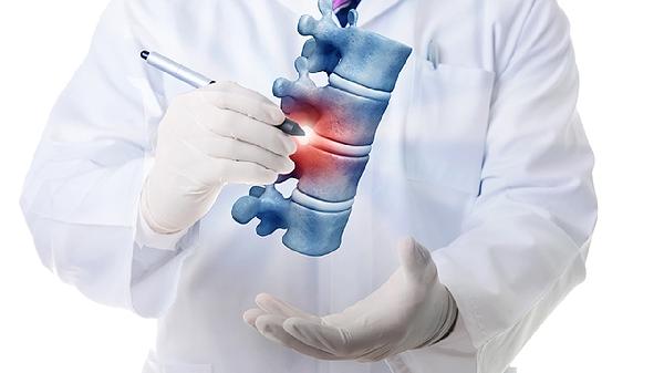 椎间盘膨出、硬膜囊受压严重吗