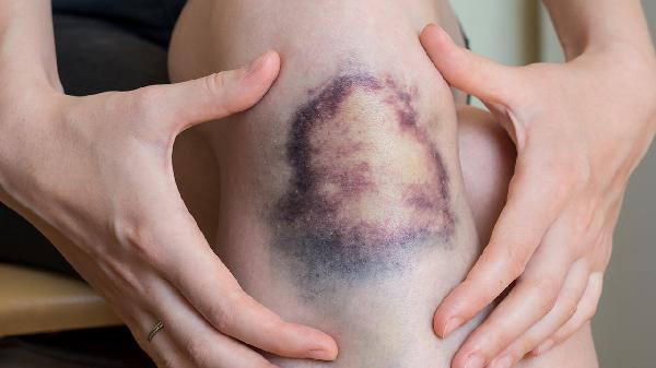 腹股沟皮肤发红溃烂发臭怎么回事，怎么办