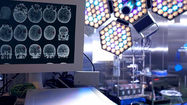 什么情况下才做冠脉CTA