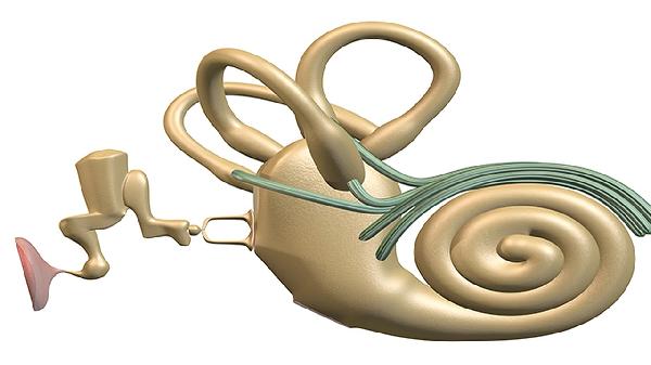 怎么判断是不是神经性的耳聋