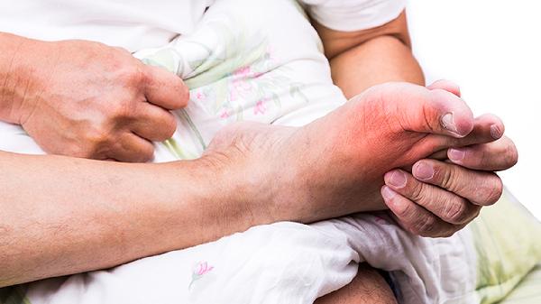 足跟痛的常见原因揭晓 足跟痛警惕是跖筋膜炎