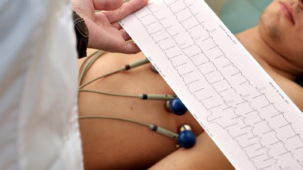 做24小时心电图监测要住院吗