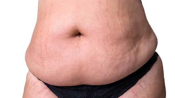 常见的引起皮肤发黄的原因是什么