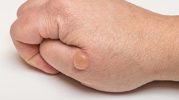 3个月宝宝吐口水泡泡怎么回事