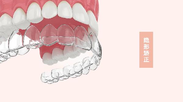 隐形矫正器和普通矫正器区别