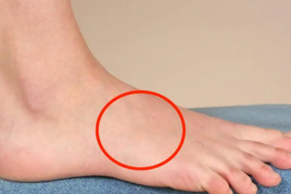 右脚二拇指根部痛是什么病