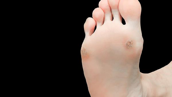 龟头上红点上有水泡怎么回事