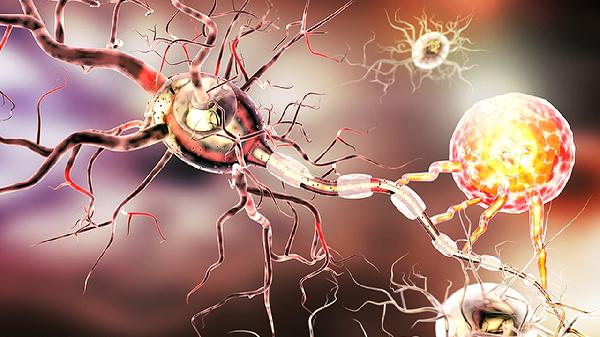 怎么治疗面神经麻痹 治疗面神经麻痹这4点很关键