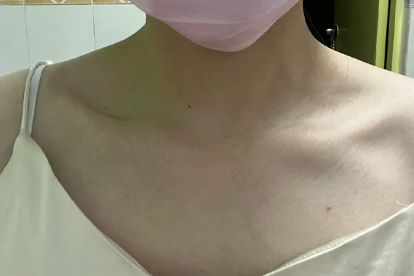 右边胸上面锁骨下面疼怎么治疗