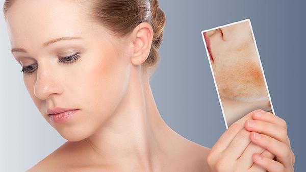 脖子两侧的皮肤变黑是咋回事