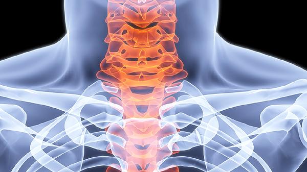 多发性骨髓瘤晚期表现有哪些