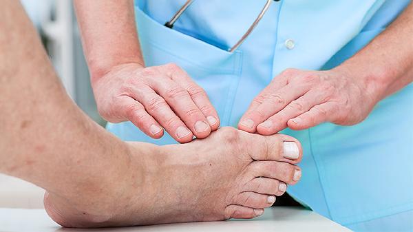 脚跟腱疼怎么治疗 脚跟腱疼的4个改善方法揭晓
