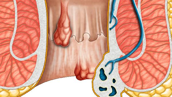 血管迷走性晕厥症状