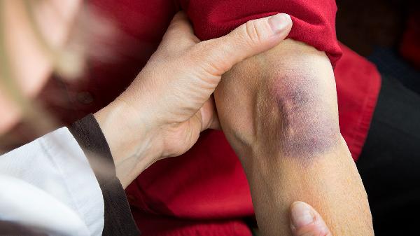 腹股沟处或闭孔处肿胀的检查方法有哪些