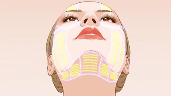 全面了解垫下巴手术方法