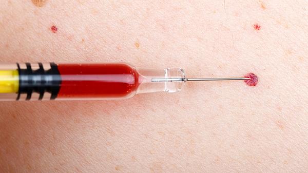 华法林吃多了出血怎么办