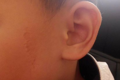 爱掏耳朵的人，可能要承受5个后果，劝你手下留情