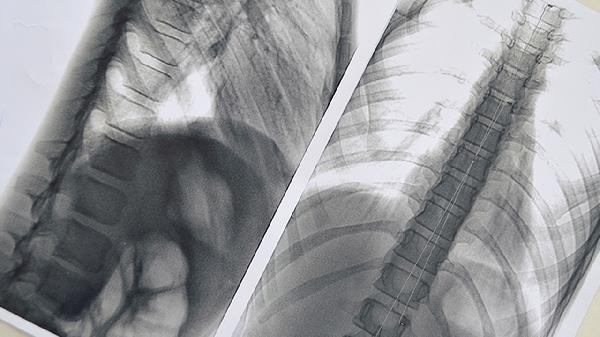 为什么有人长期吸烟却不得肺癌？主要有两个原因，医生说明白了