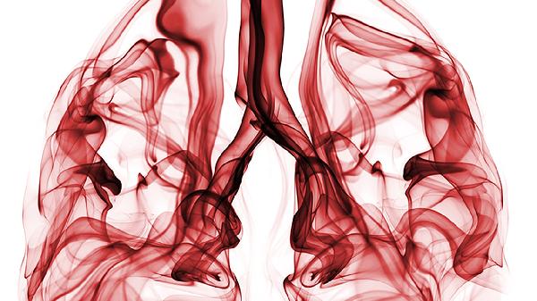 得了肺癌能活多久?4个关键因素,决定肺癌患者的生存期